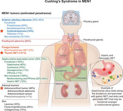 Expressions of Cushing’s syndrome in multiple endocrine neoplasia type 1